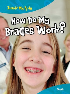 cover image of How Do My Braces Work?